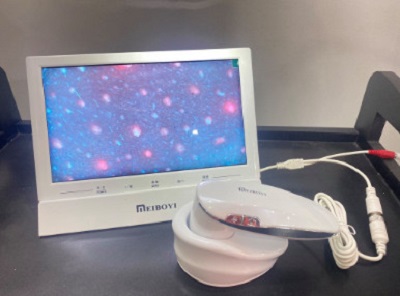 Máy soi da tóc máy tính bảng Ipad Meiboy M-906