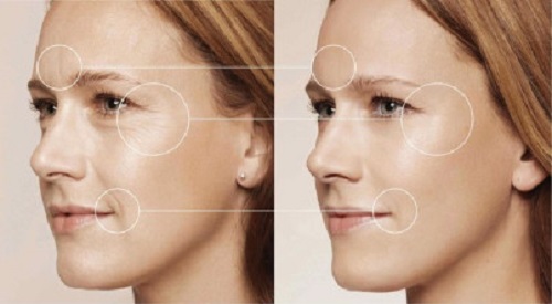 kem chong nhan da deoprce Bio Anti Wrinkle Horse Oil Cream chiet xuat tu mo ngua
