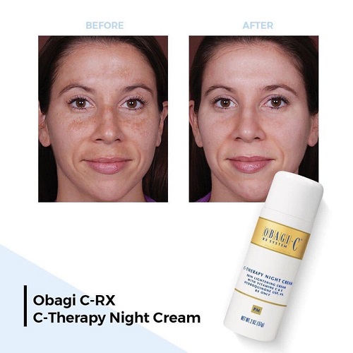 Kem duong da ban dem mo tham nam Obagi C Fx Therapy Night Cream