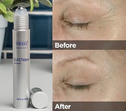 Kem lam giam tham mat, chong nhan Obagi Elastiderm Eye Complete Complex Serum