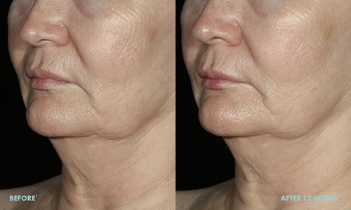 serum nang co, chong lao hoa Obagi Elastiderm Facial Serum