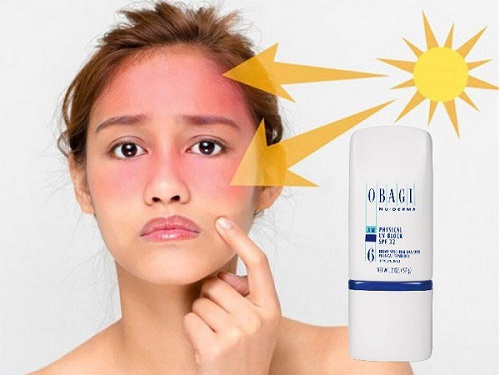 Kem chong nang vat ly Obagi Nu-Derm Physical UV Broad Spectrum SPF 32