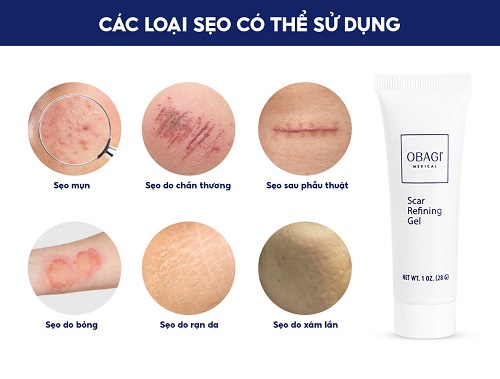 Gel phuc hoi, lanh thuong, ngua seo giau Peptides Scar Refining Gel