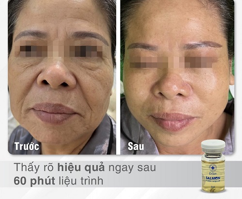 tinh chat DNA ca hoi