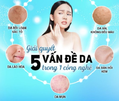 kem vi kim tao bien Désembre Exfoliator 3in1 Peeling Cream 1