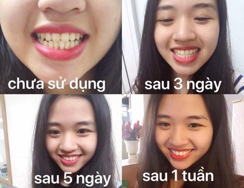 May lam trang rang mini Rio DCWU