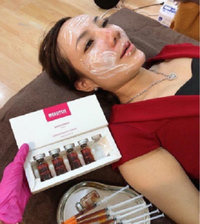 thuoc tiem Mesotox Brightening Solution Isov tri nam