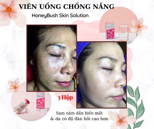 Vien uong chong nang